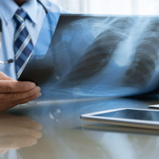 Respiratory Health Surveillance